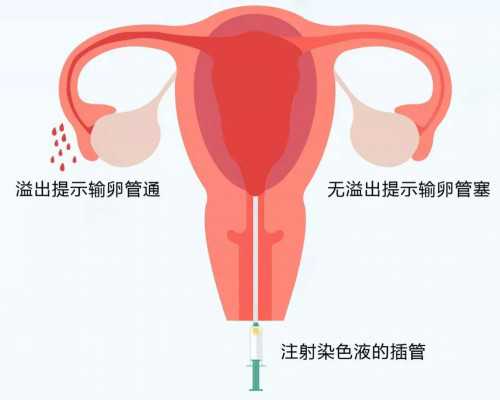 北京私人代孕网站,北京供卵试管包成功博客,北京国内试管供卵机构