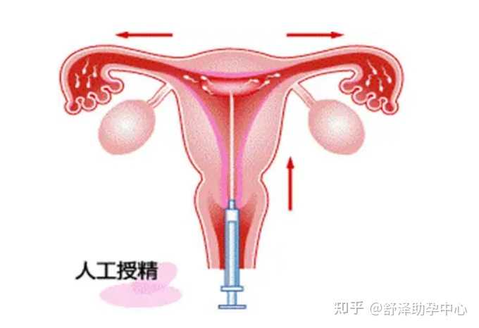 北京几个助孕公司？,目前常见的辅助生殖技术总结