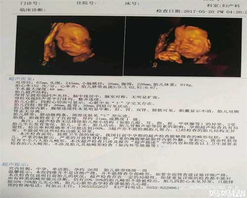 北京权威代怀孕零首付-瘦的人可以怀双胞胎吗