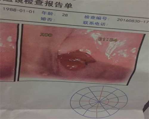 北京代孕机构有吗：北京找代孕中介：孕妇吃甘蔗上火吗