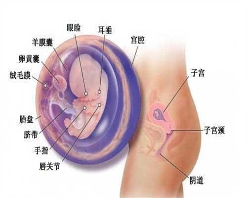 北京代孕靠谱机构：白内障怎么确诊？白内障怎么缓解？